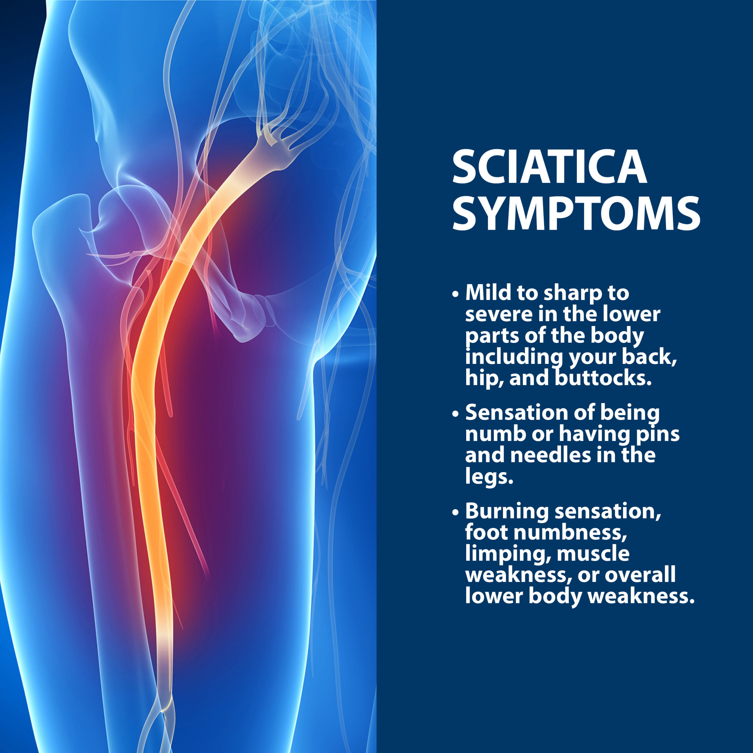 Sacroiliac Joint Exercises For Sciatica Pain Relief Infographic