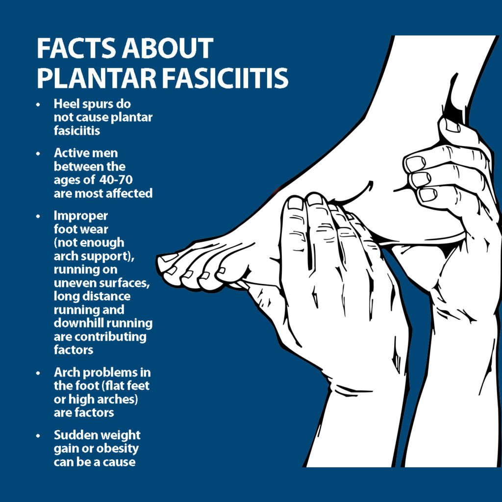 Plantar Fasciitis Info Florida Orthopaedic Institute