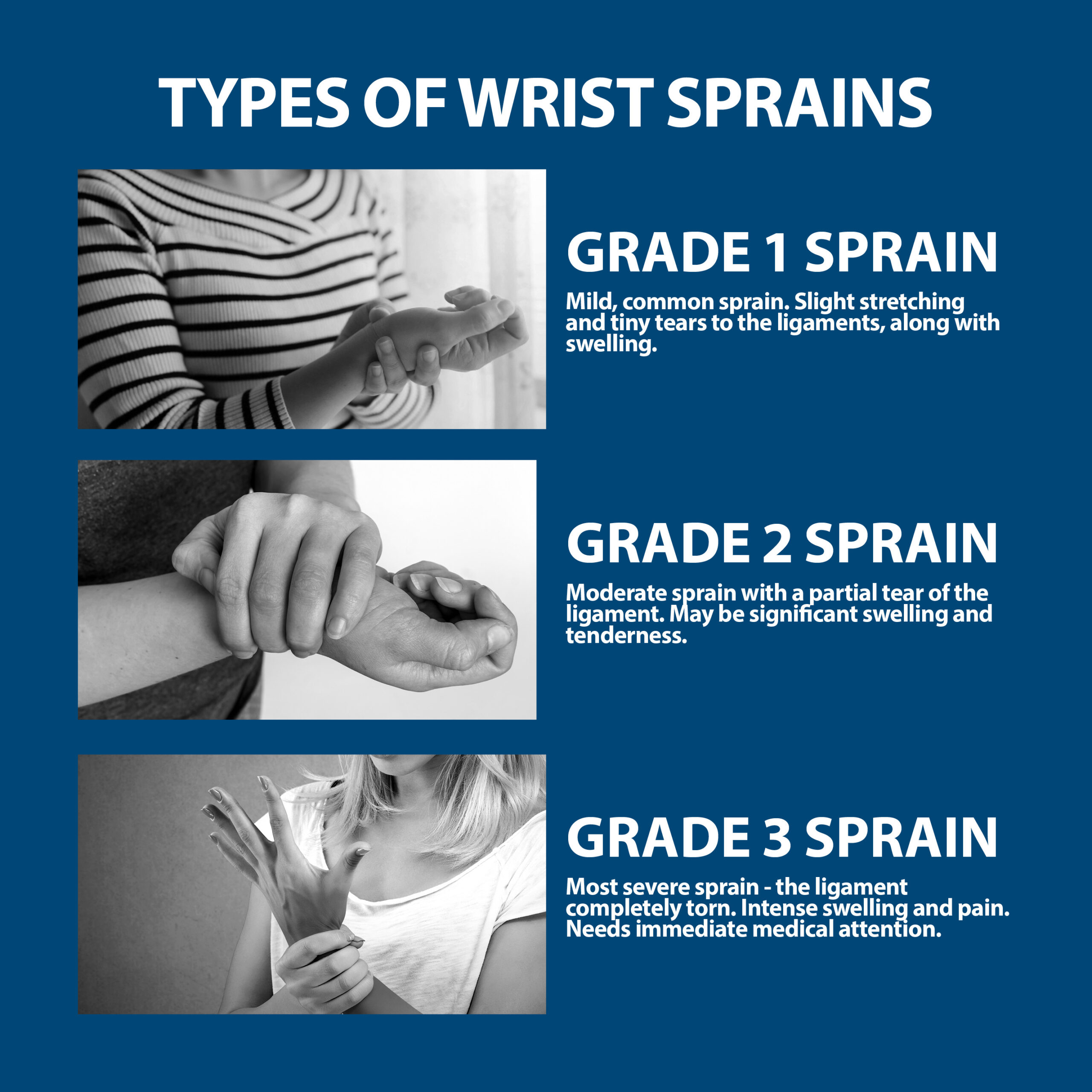 Wrist Sprains and Grades