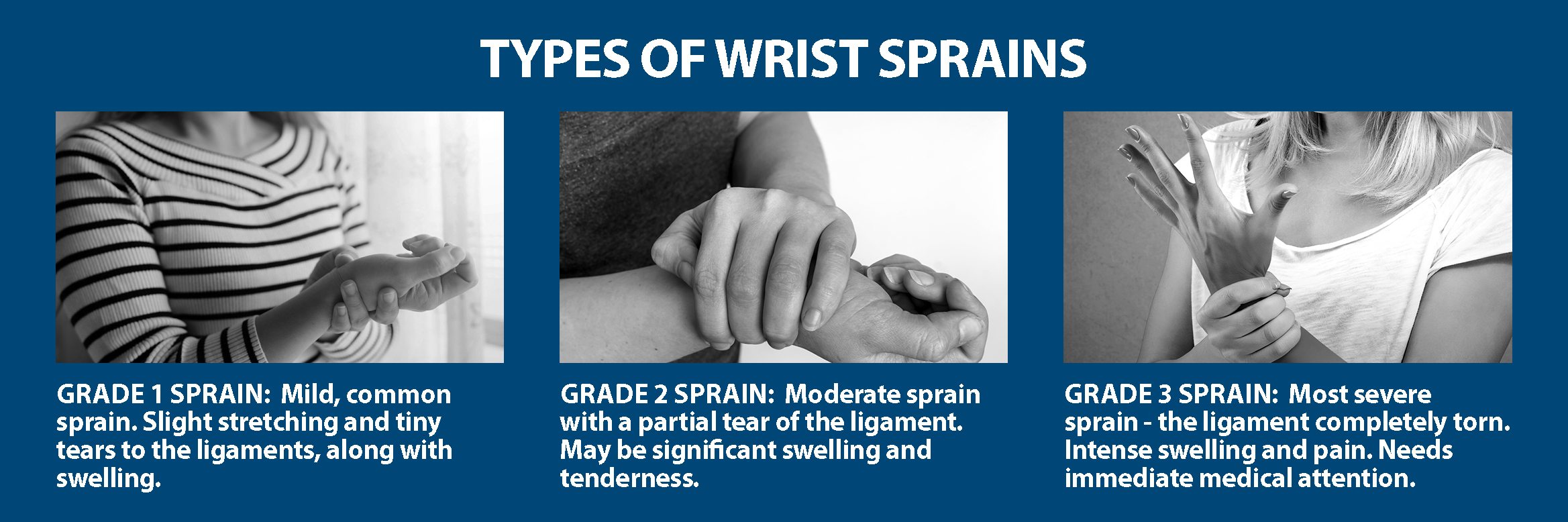 Wrist Sprains Information 