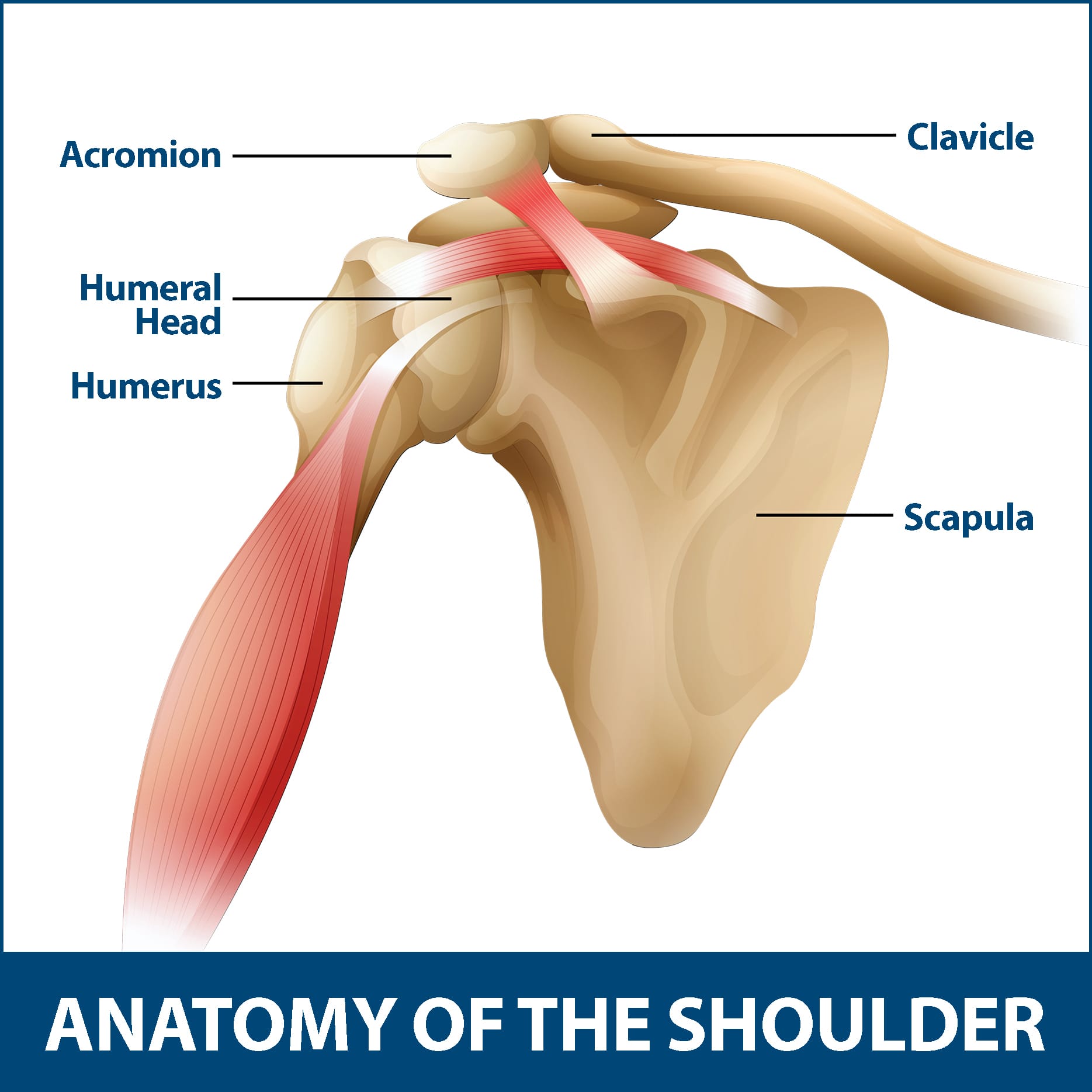 Bursitis of the Shoulder and Shoulder Arthritis