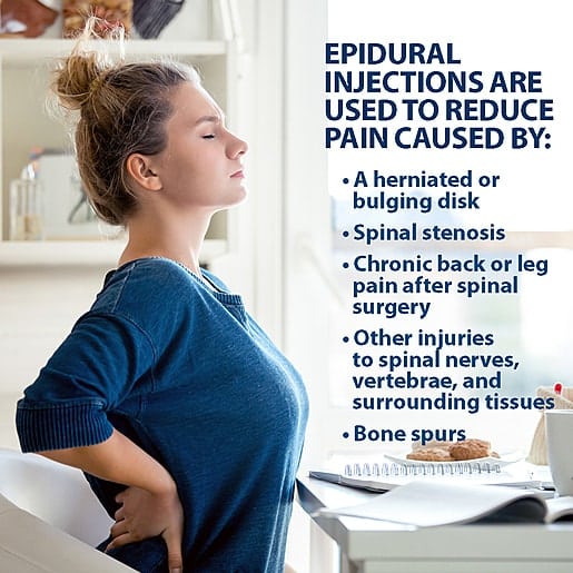 Epidural injections for spinal pain