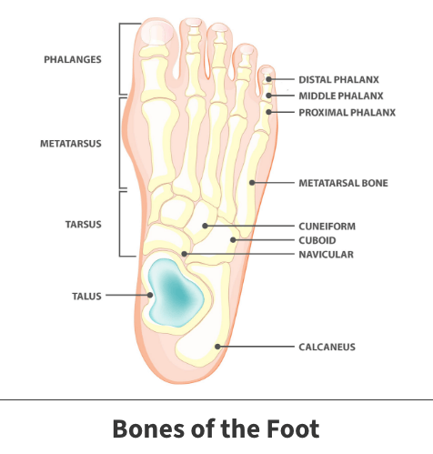 Hallux Rigidus Surgery, diagram of the bones of the foot