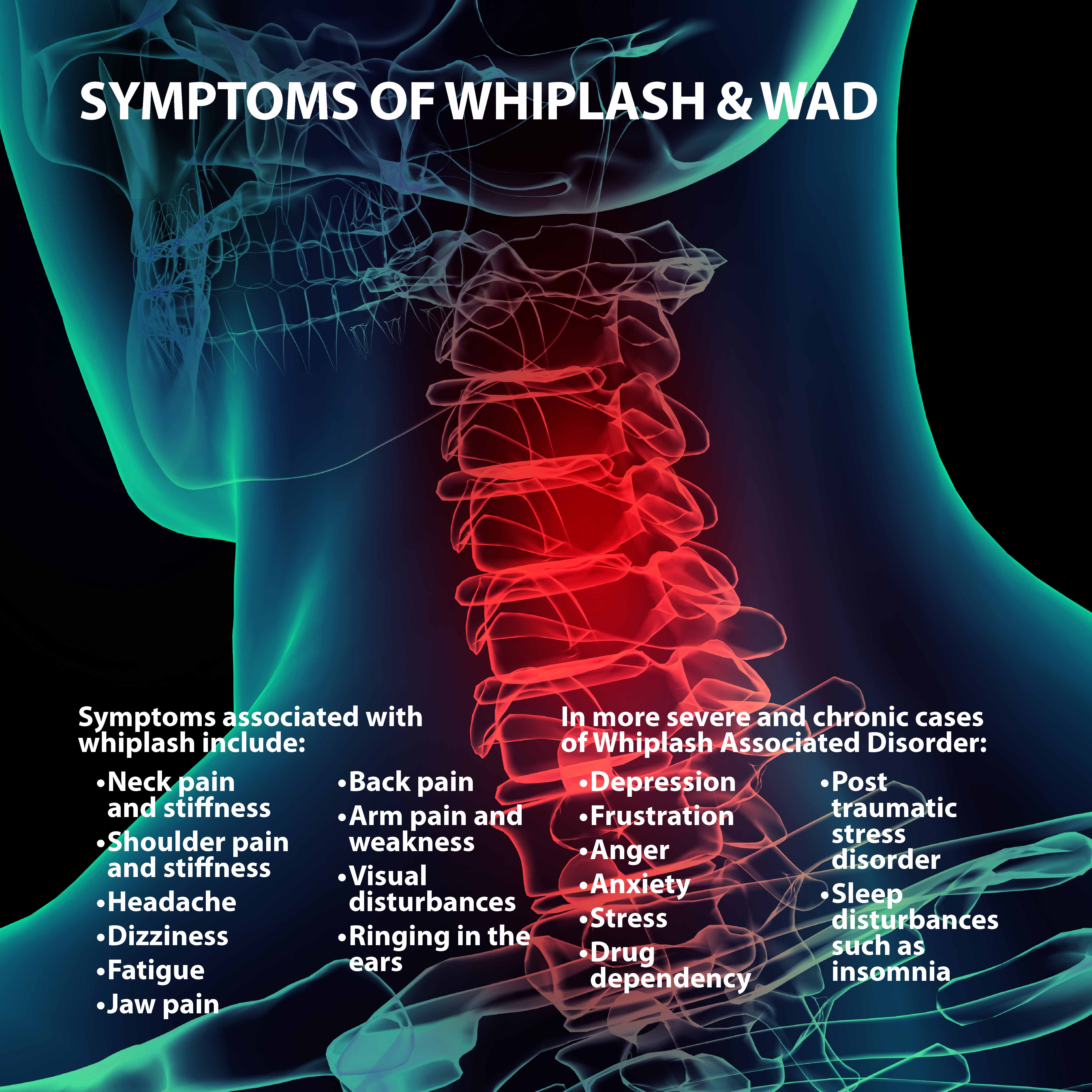 Symptoms of Whiplash Graphic