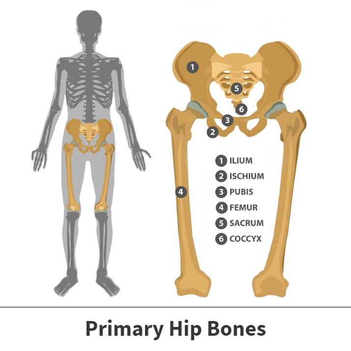 Hip dislocation graphic