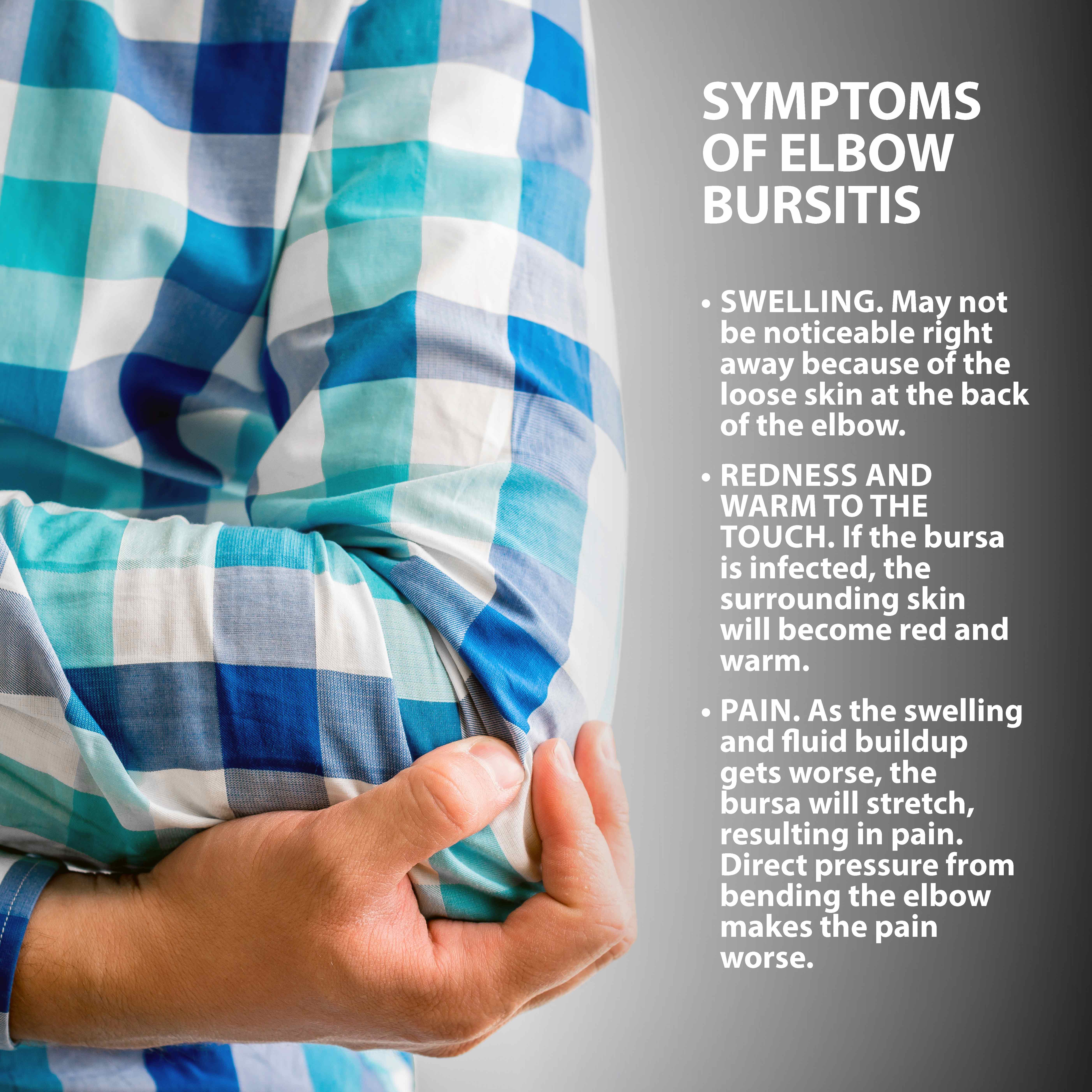 elbow bursitis symptoms graphic