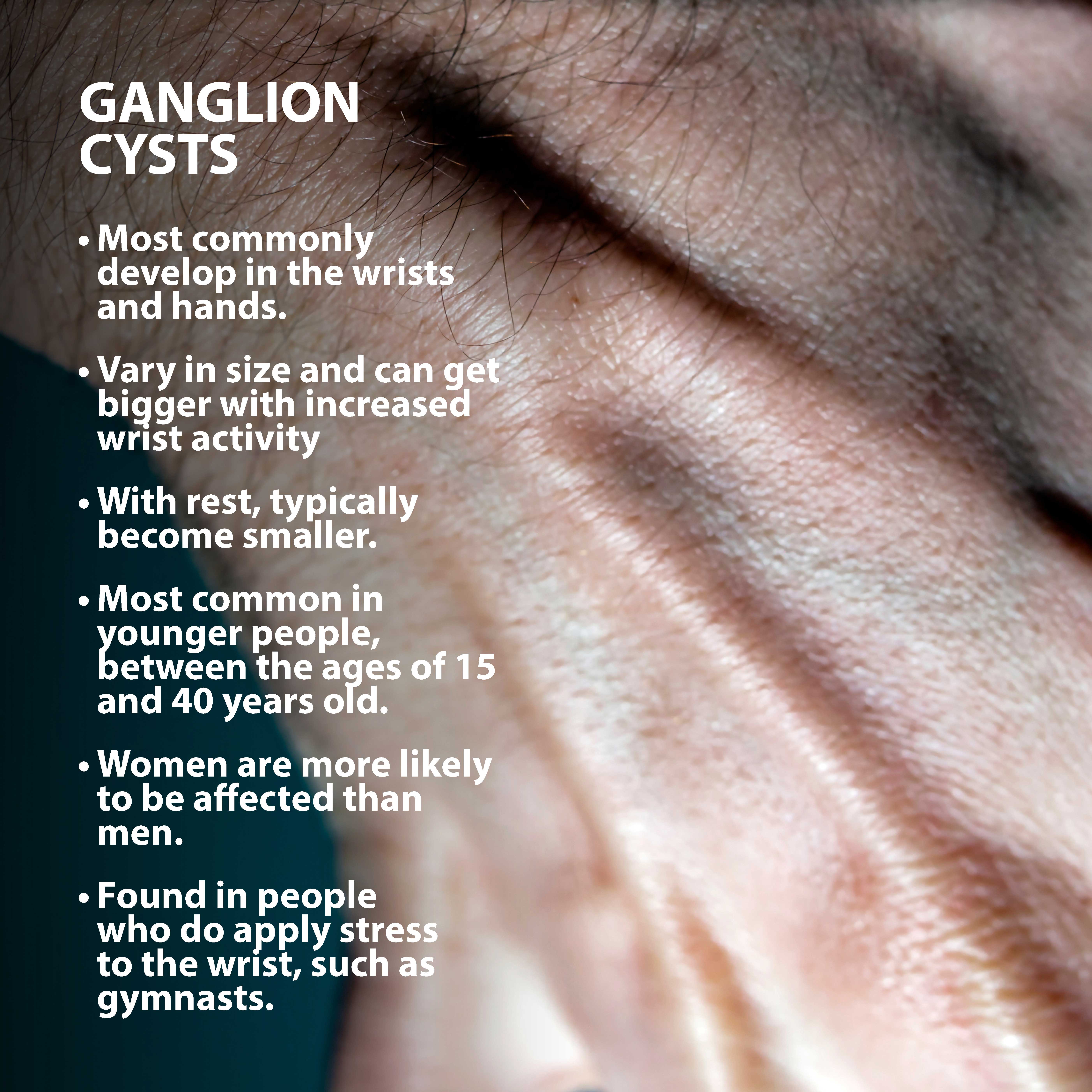 ganglion cysts symptoms graphic