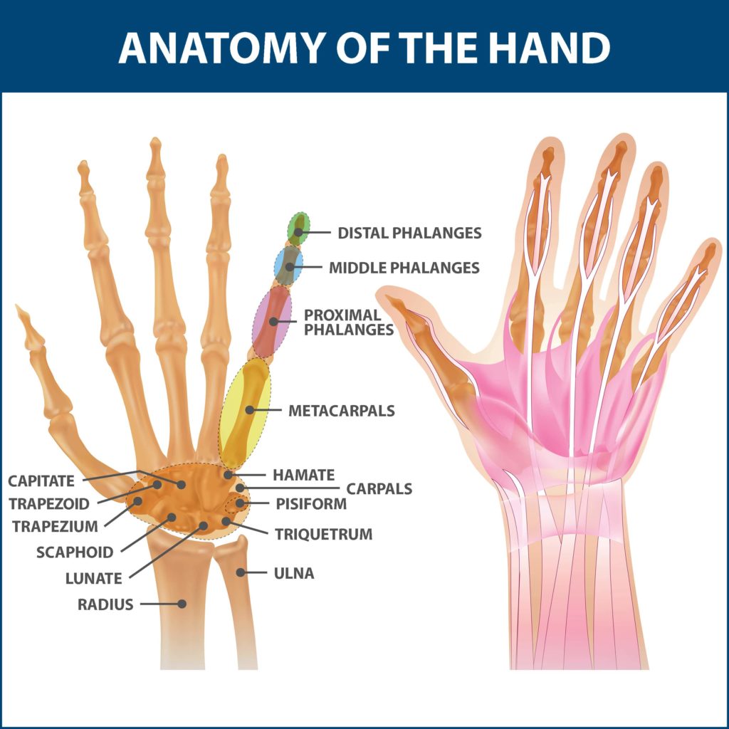 Rheumatoid Arthritis Of The Hand Florida Orthopaeidic