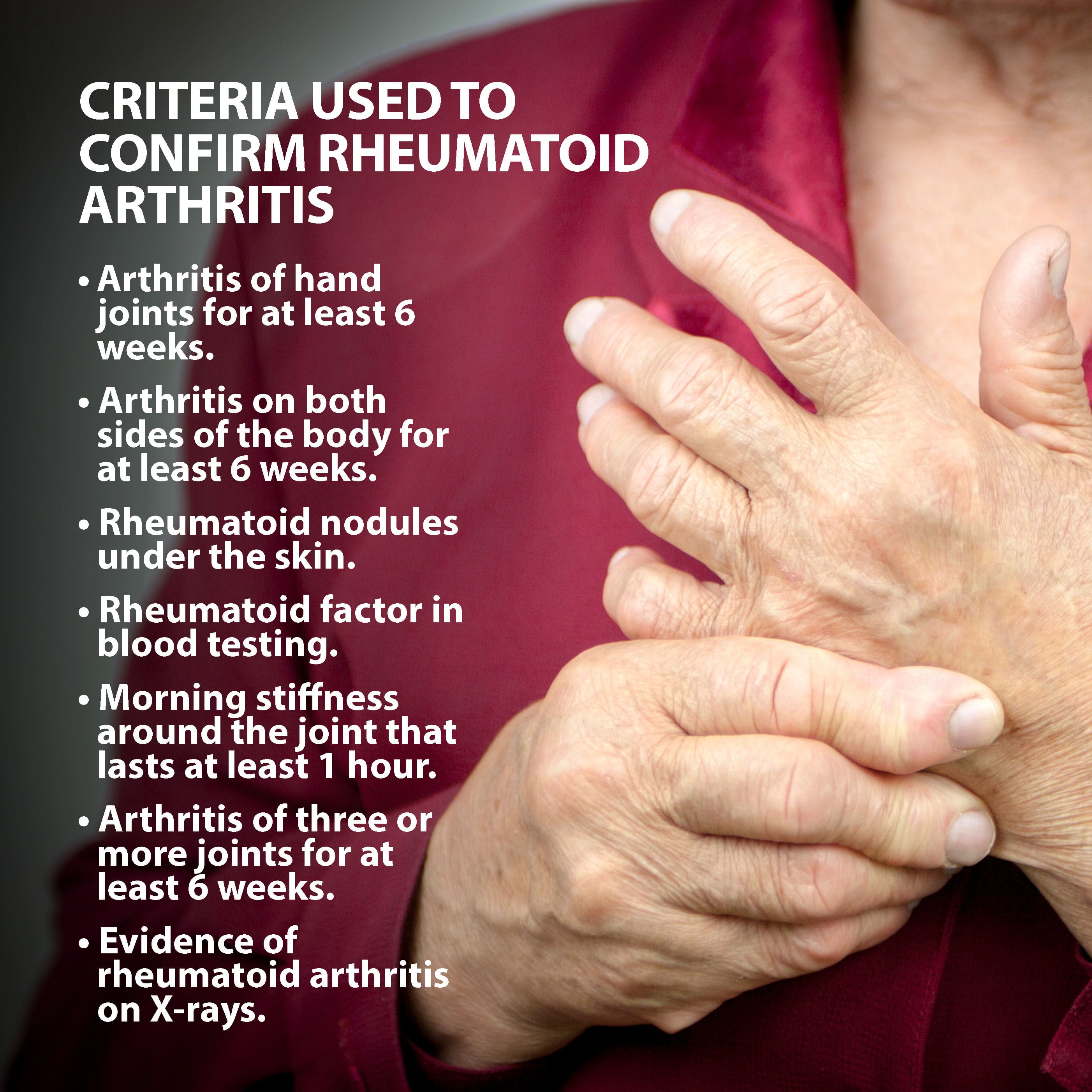 rheumatoid arthritis bursitis a könyökízületben)