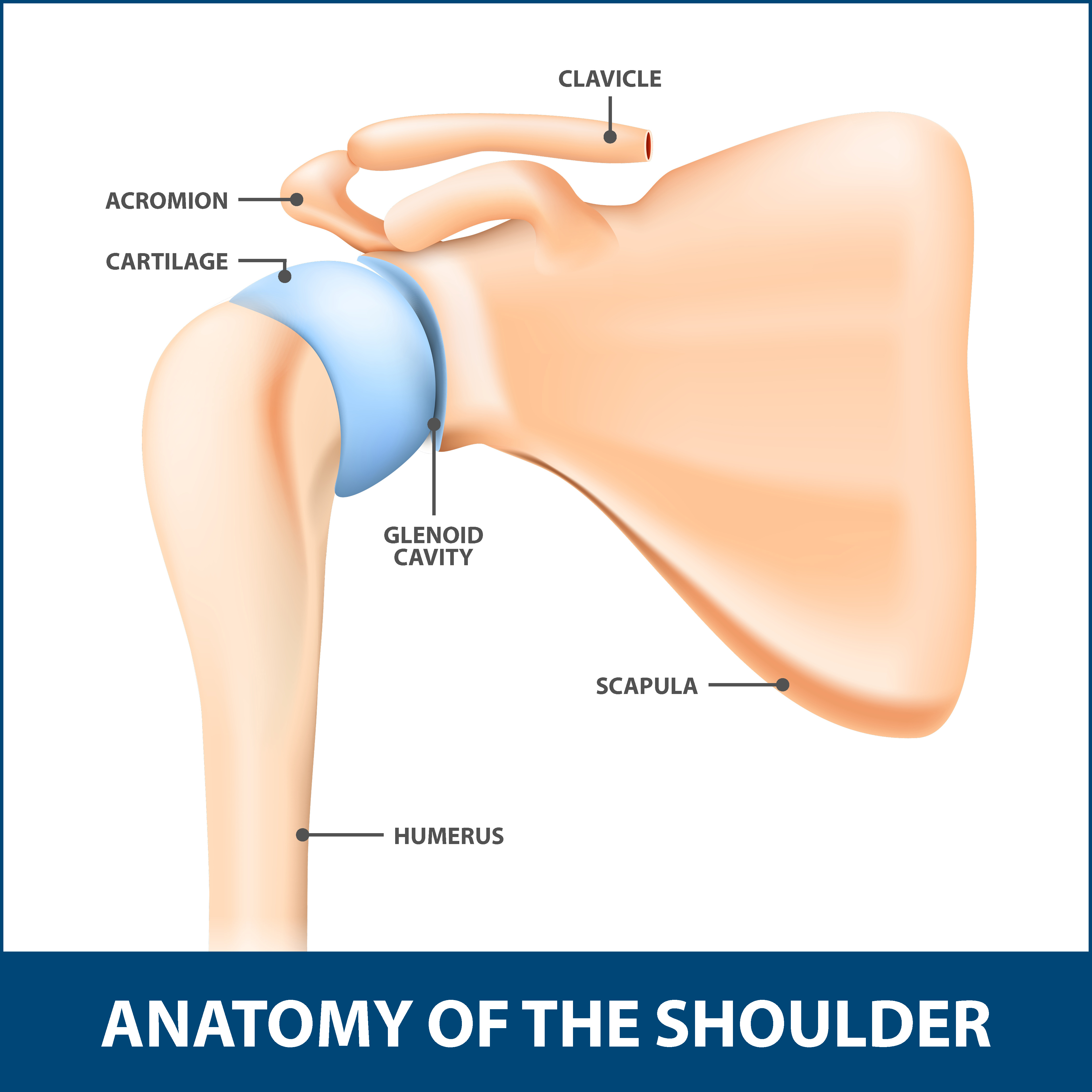Shoulder Glenoid Fracture