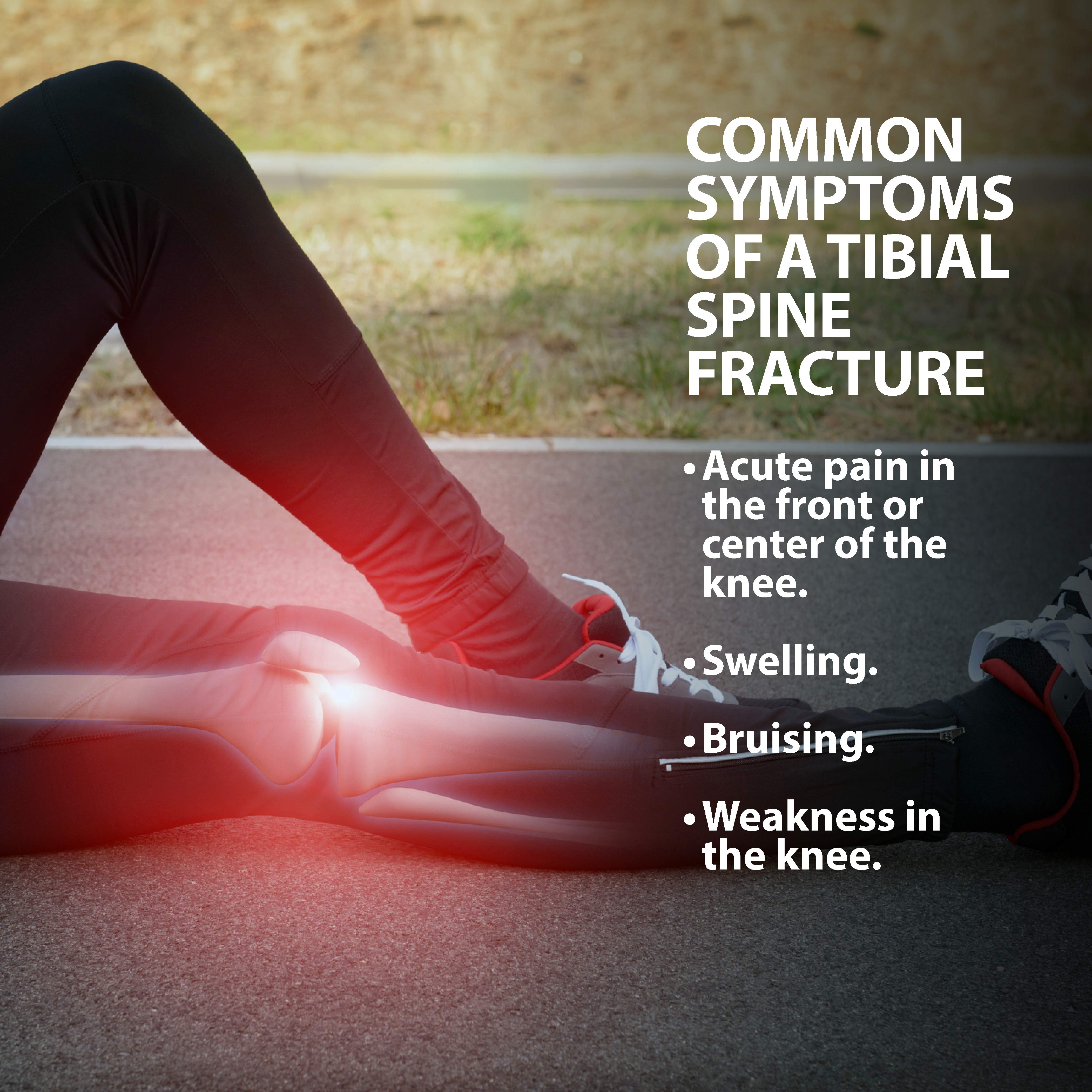 Tibial Spine Fracture Symptoms