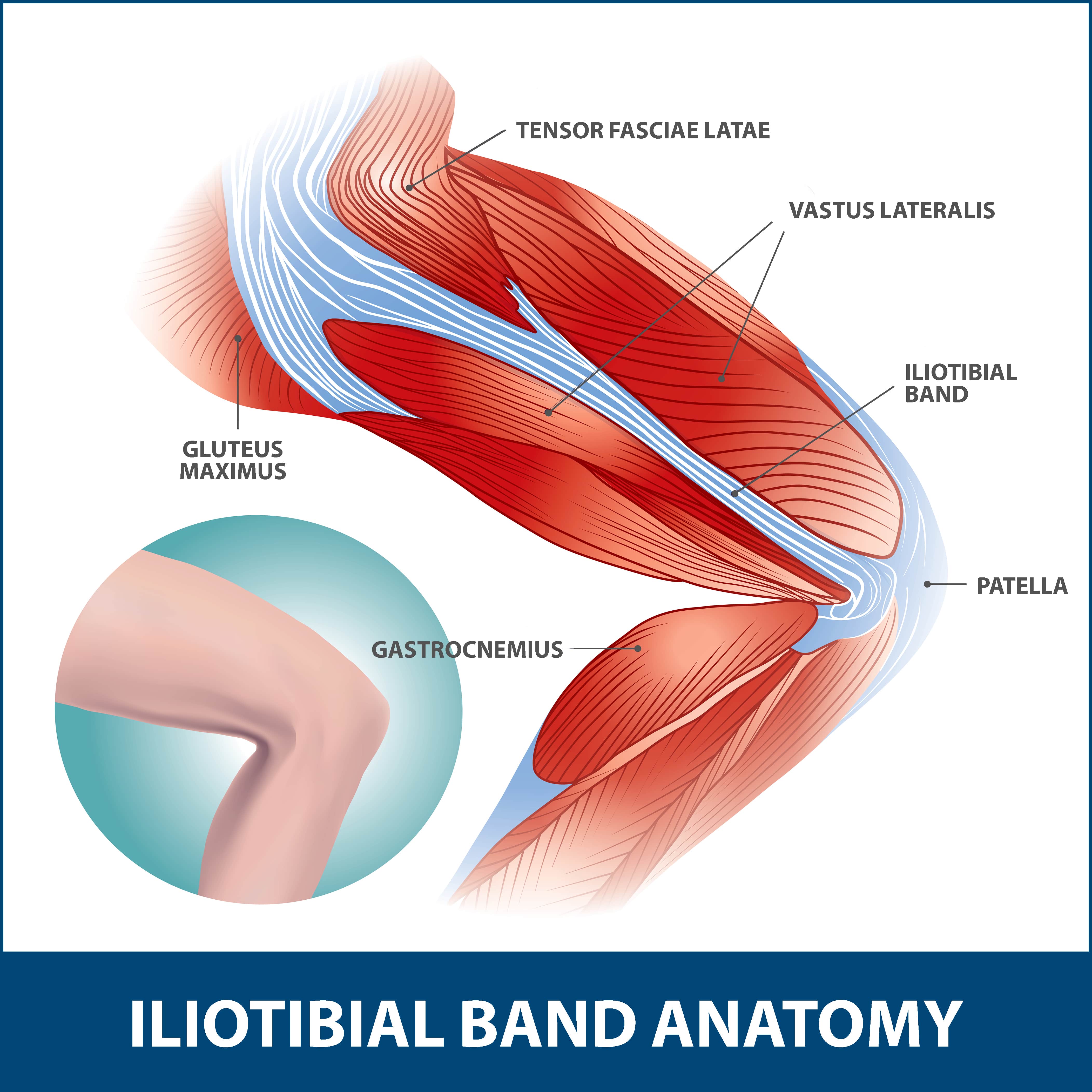 iliotibial band friction syndrome)