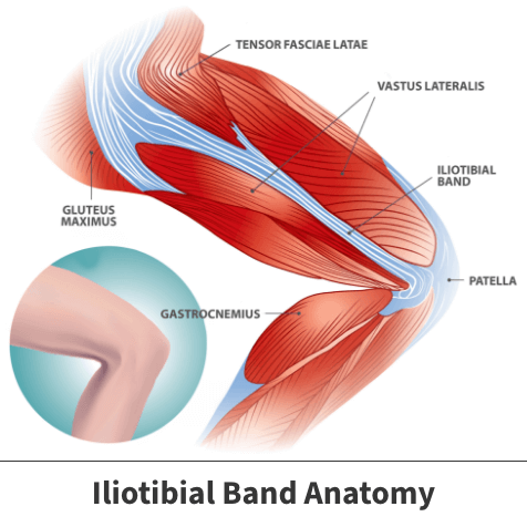 iliotibial tract pain