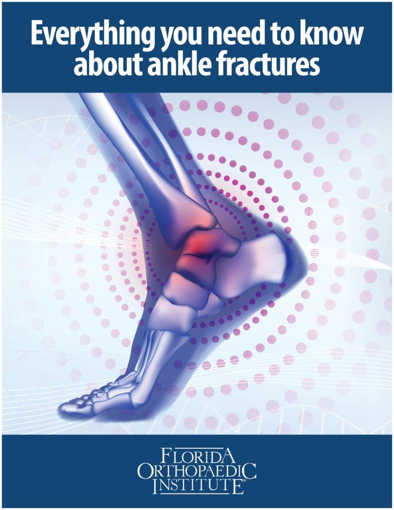 Fractured Ankle Symptoms | Florida Orthopaedic Institute