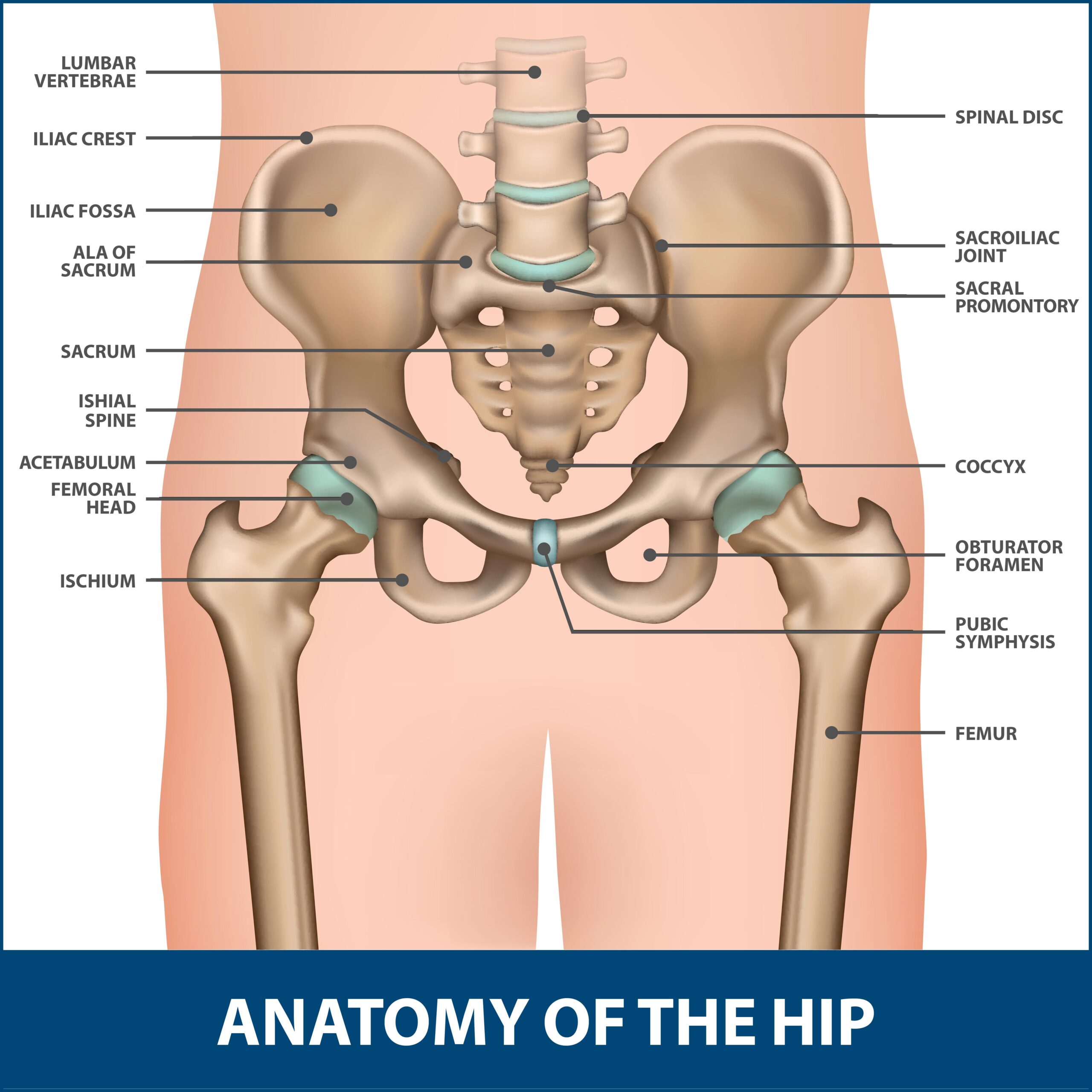 Total Hip Replacement - Anterior Approach
