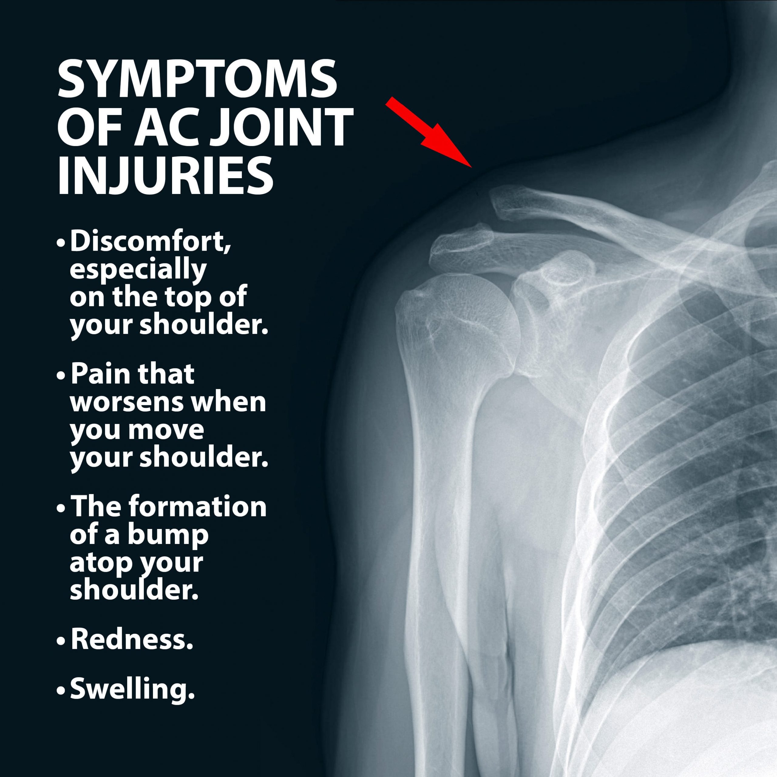 Joint Injuries | Florida Orthopaedic Institute