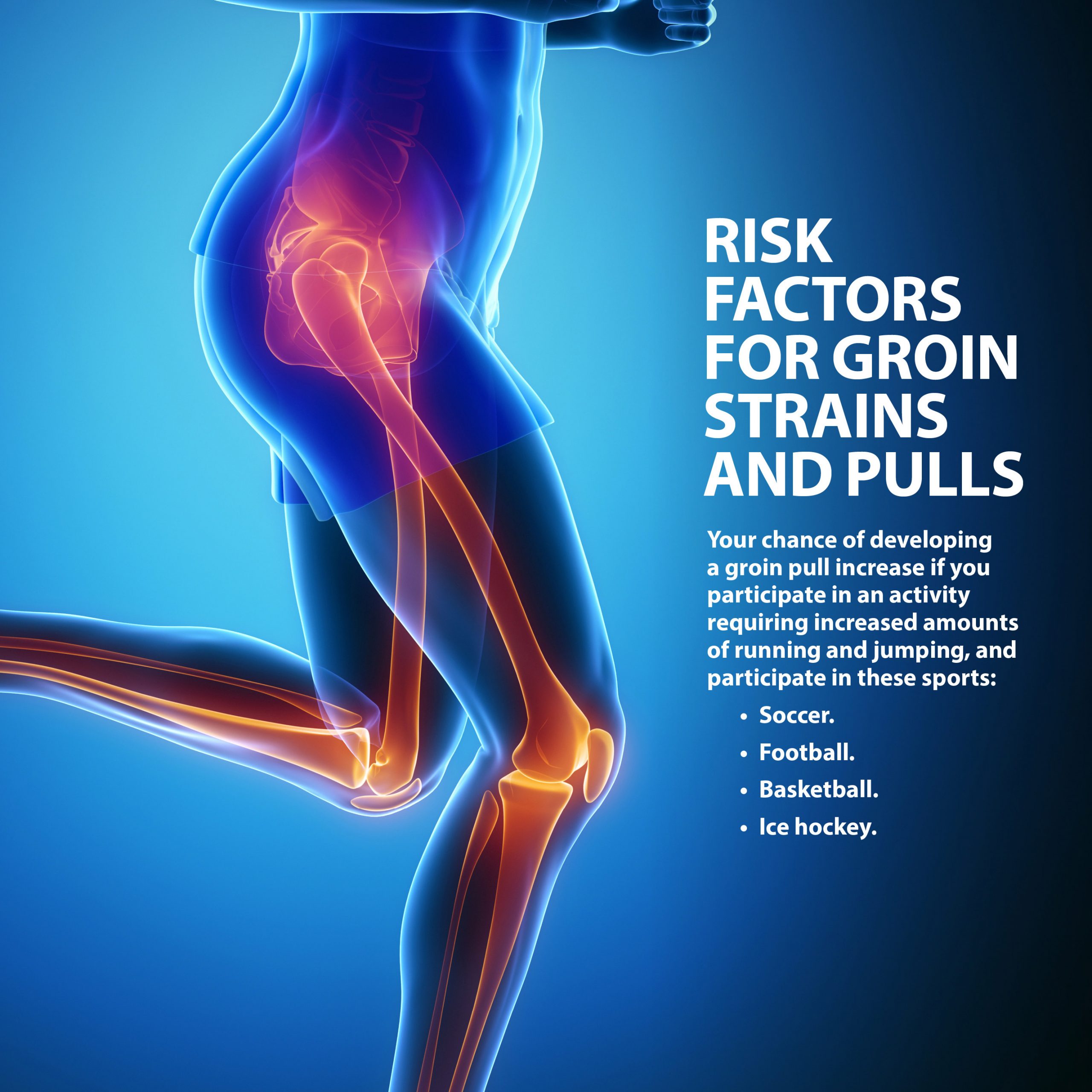 Groin Muscle Strains & Pulls  Florida Orthopaedic Institute