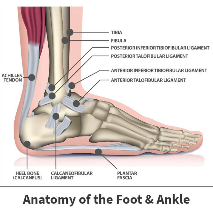 Heel Pain in Kids and Teenagers /Sever's Disease — Osteo for families