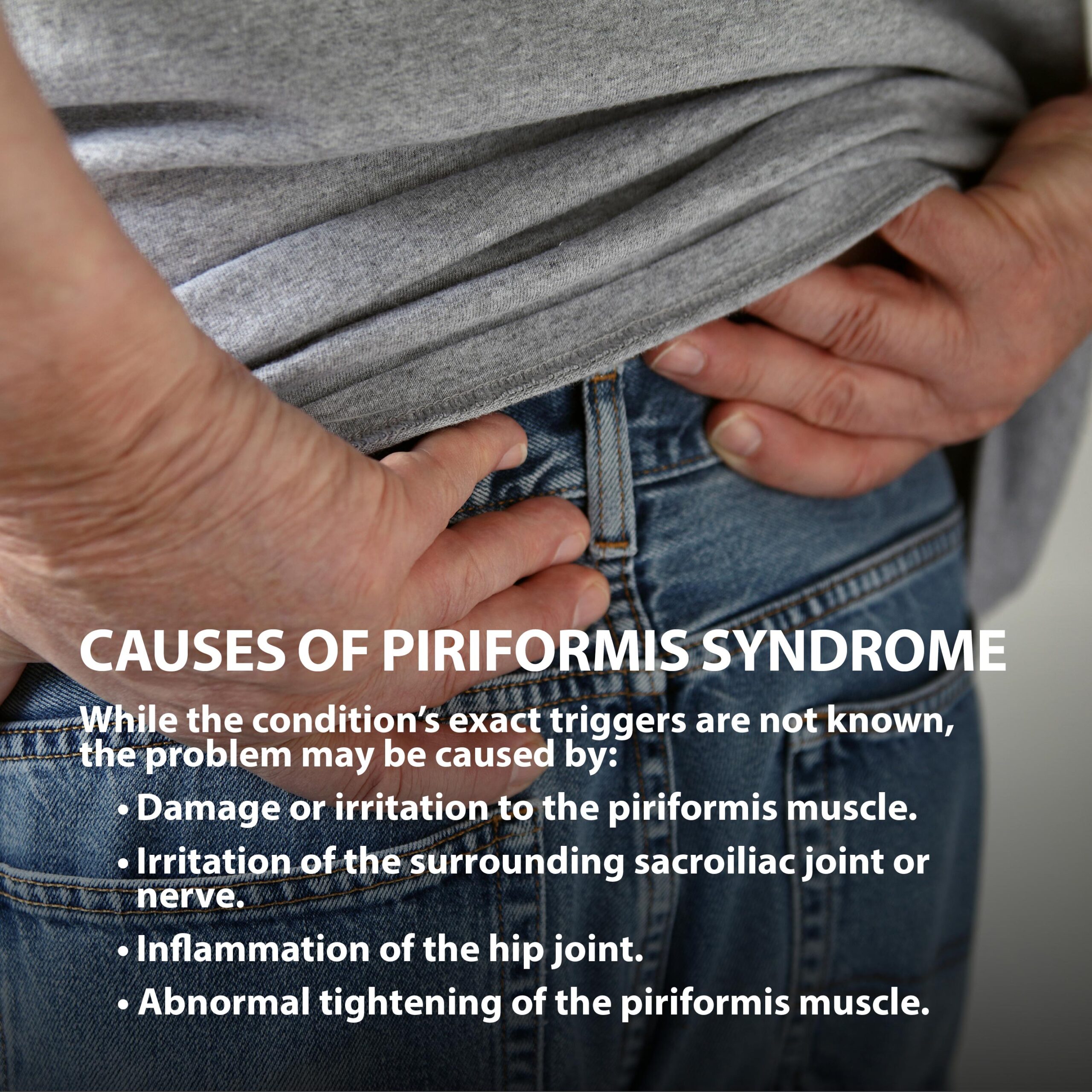 Piriformus Syndrome Information and Treatments
