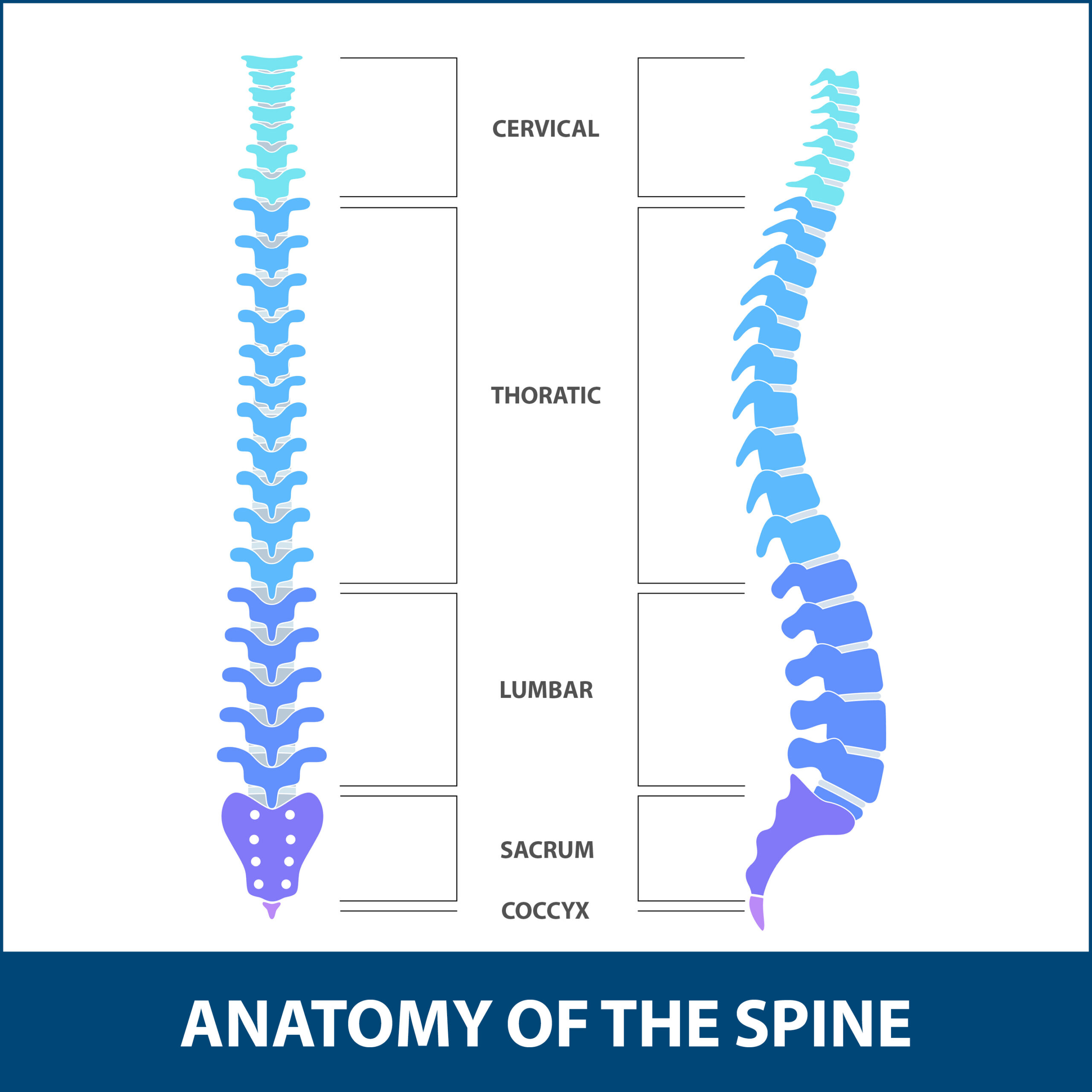 spine illustration to show where vertebroplasty - bone cement injection - can be performed