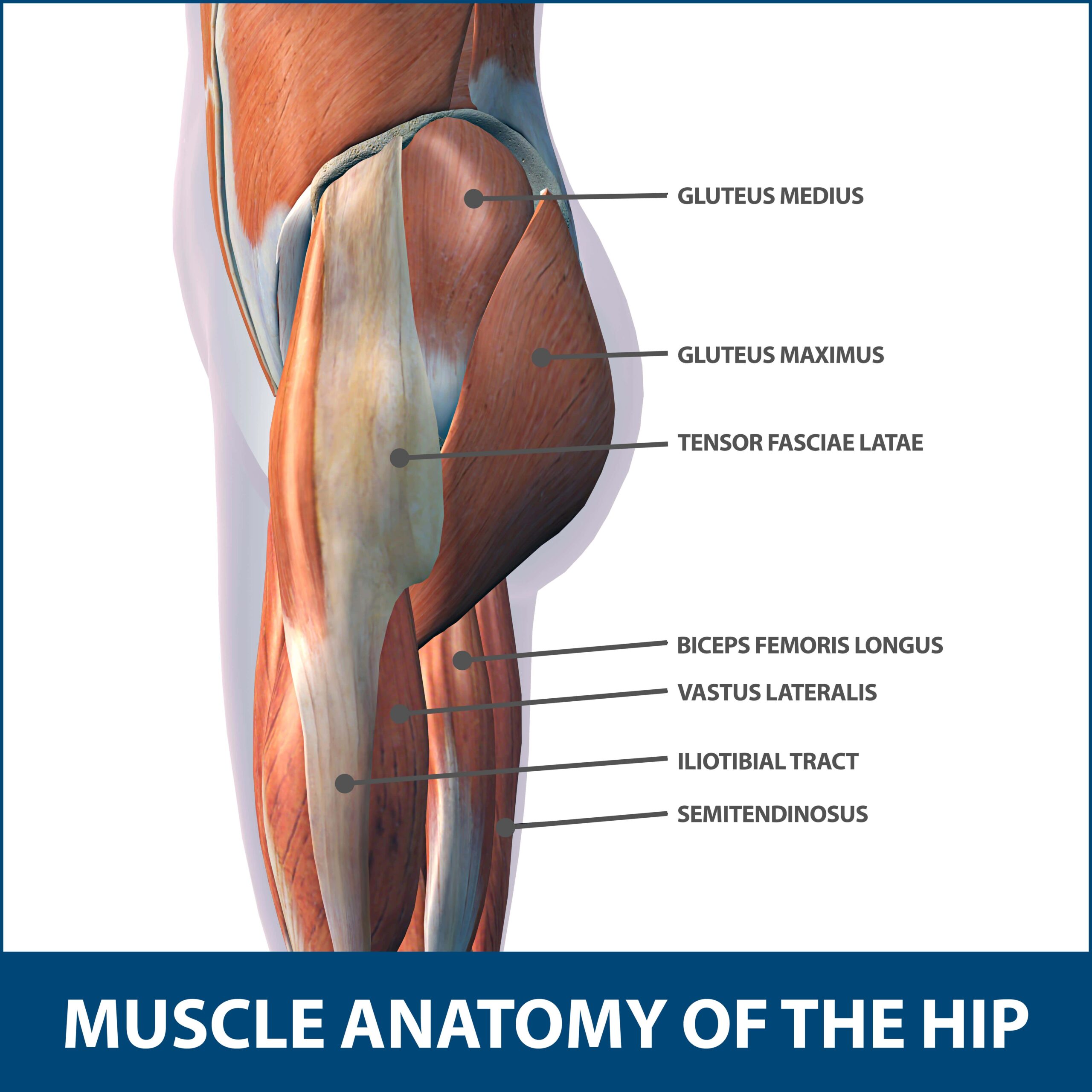 Hip Muscle Strains Info  Florida Orthopaedic Institute