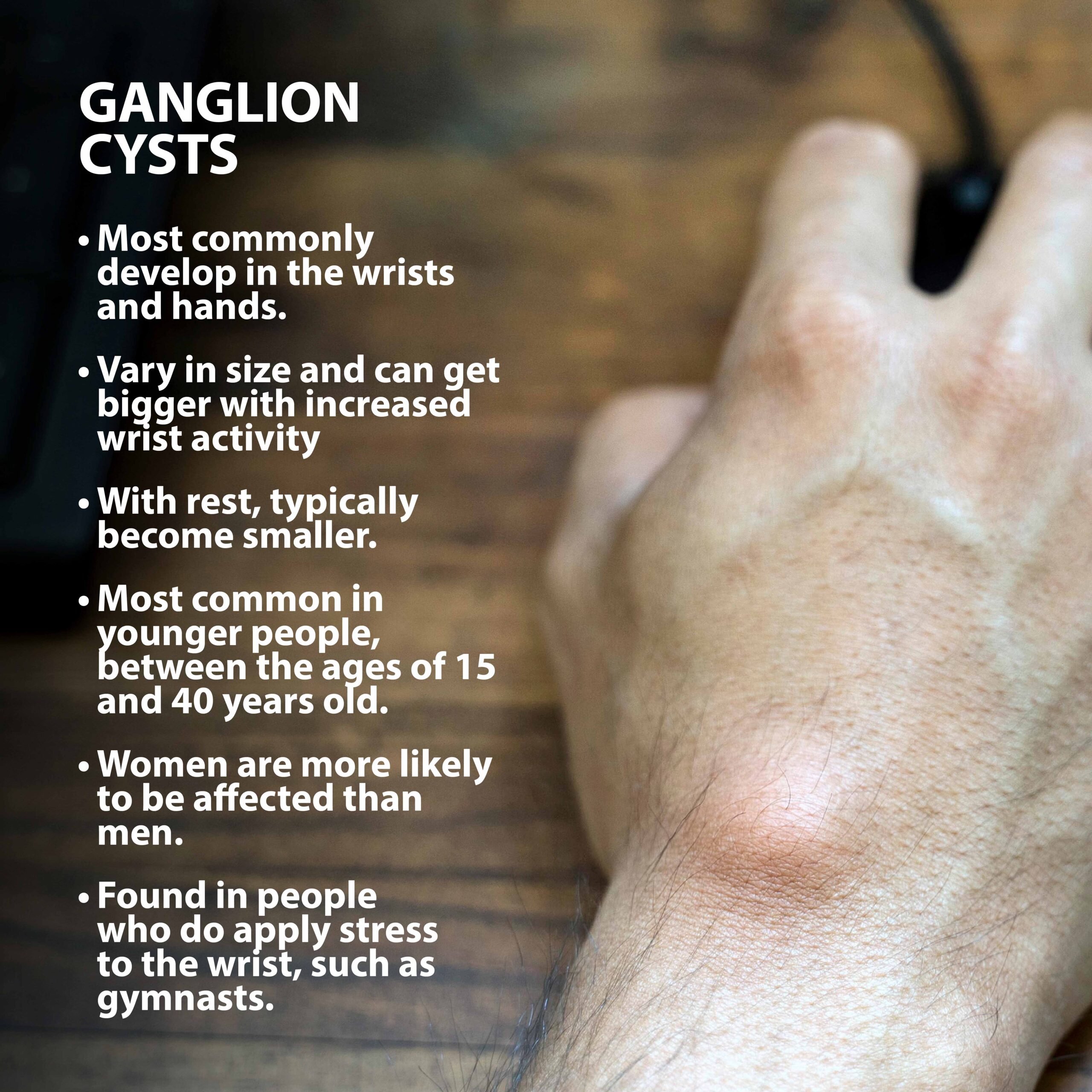 Ganglion Cyst wrist treatment