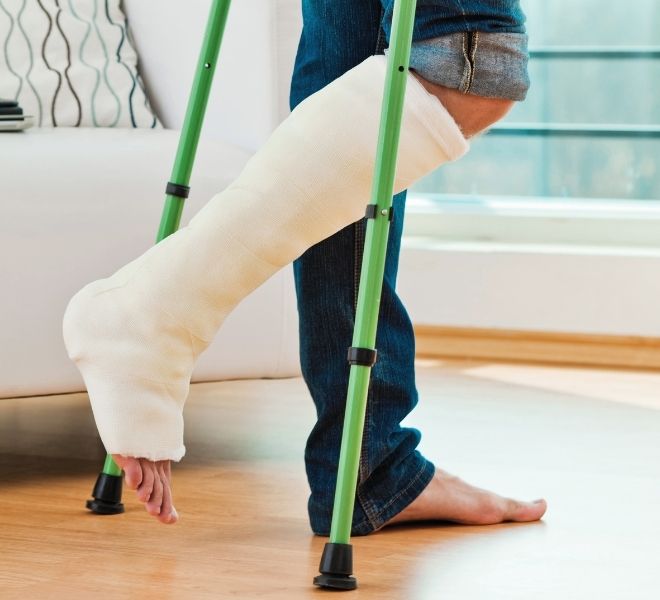 Man walking on casted leg with crutches