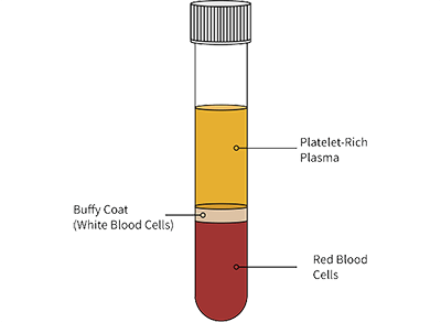 Illustration of a vial showing three tiers, from top to bottom: Platelet-Rich Plasma, Buffy Coat (White Blood Cells), Red Blood Cells